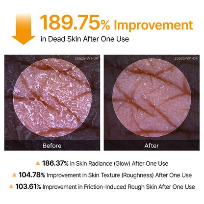 Peel Shot Spray Soin Kératose Acide Kojique & Curcuma